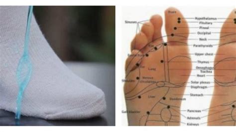Kedutan telapak kaki kanan samping  Pada penyakit neuropati diabetes, kesemutan umumnya muncul dari kedua telapak kaki, naik ke seluruh kaki, menjalar